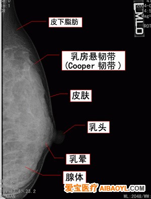 認識乳腺鉬靶照片 - 馬夫 - 馬夫的博客