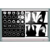 LED2000不可調(diào)光觀型片燈 價(jià)格