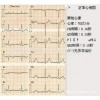 日本杰斯特chest肺功能儀打印紙HI-101