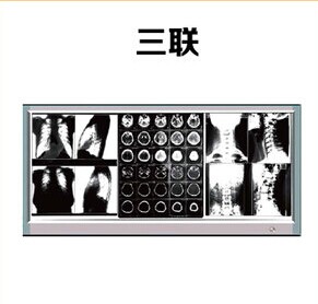 三聯(lián)1