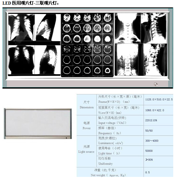 新型LED觀片燈 單聯(lián) 雙聯(lián) 三聯(lián) 四聯(lián)9