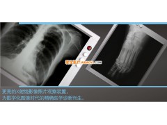 愛寶醫(yī)療供應(yīng) 插片型調(diào)光觀片燈