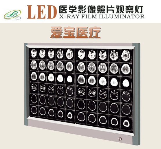 LED4000四聯(lián)調(diào)光插片型觀片燈