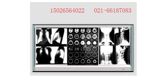 醫(yī)用x光膠片觀片燈三聯(lián)觀片燈,，單聯(lián)超薄單聯(lián)觀片燈