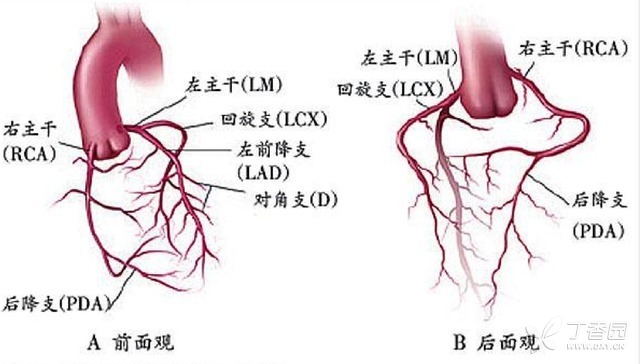 急性 ST 段抬高型心梗：手把手教你判斷罪犯血管