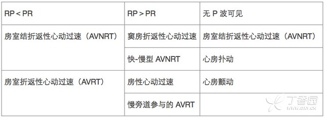 窄 QRS 波心動(dòng)過(guò)速：這些鑒別診斷方法不可不知