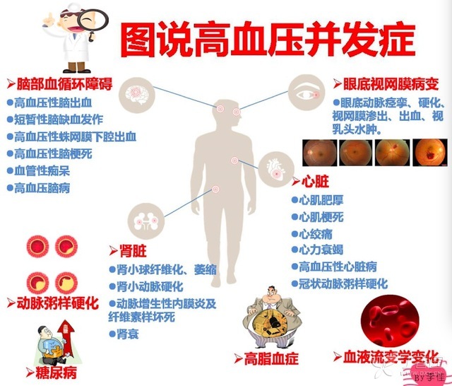 一圖讀懂：說(shuō)說(shuō)高血壓并發(fā)癥