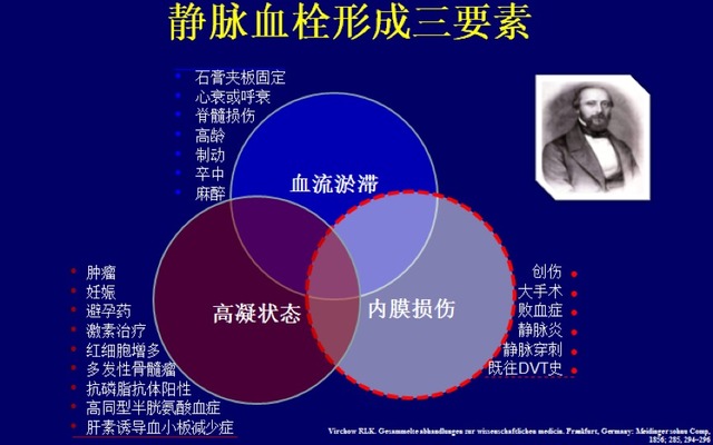 輕松 10 分鐘：掌握肺栓塞的臨床診療經(jīng)驗