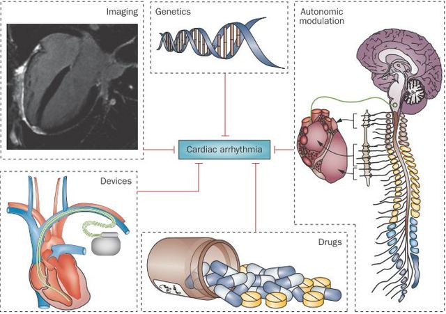 盤點(diǎn)2014心律失常研究進(jìn)展