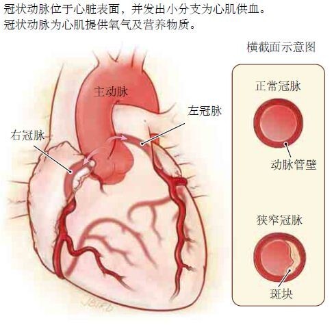 如何檢測(cè)「沉默型」冠心?。?></a>
<span id=