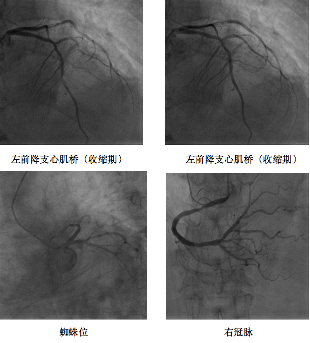 急腹癥突發(fā)胸痛,，原因竟然是這個,！