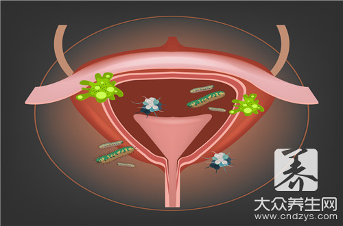 急性膀胱炎應(yīng)該用什么藥?