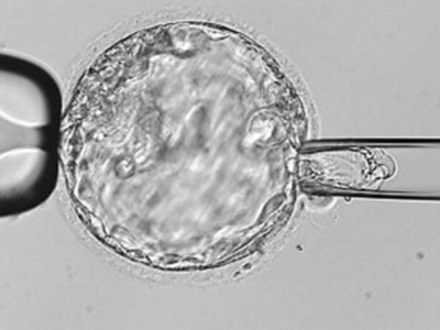 試管嬰兒移植失敗后胚胎去哪里了?