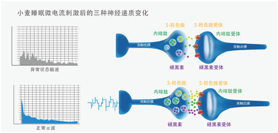 小麥睡眠治失眠物理療法，經顱微電流刺激告別失眠,！